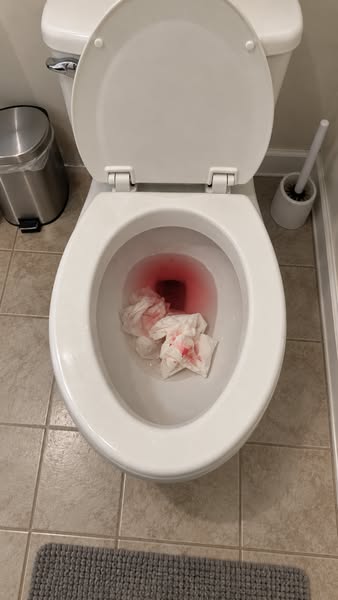 The Gross Photo Made Me Stop. The Symptoms Made Me Read.