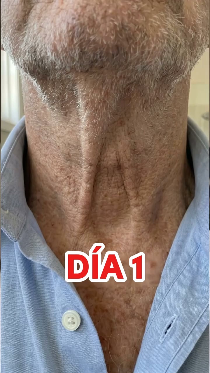 Una piel más fuerte y atractiva