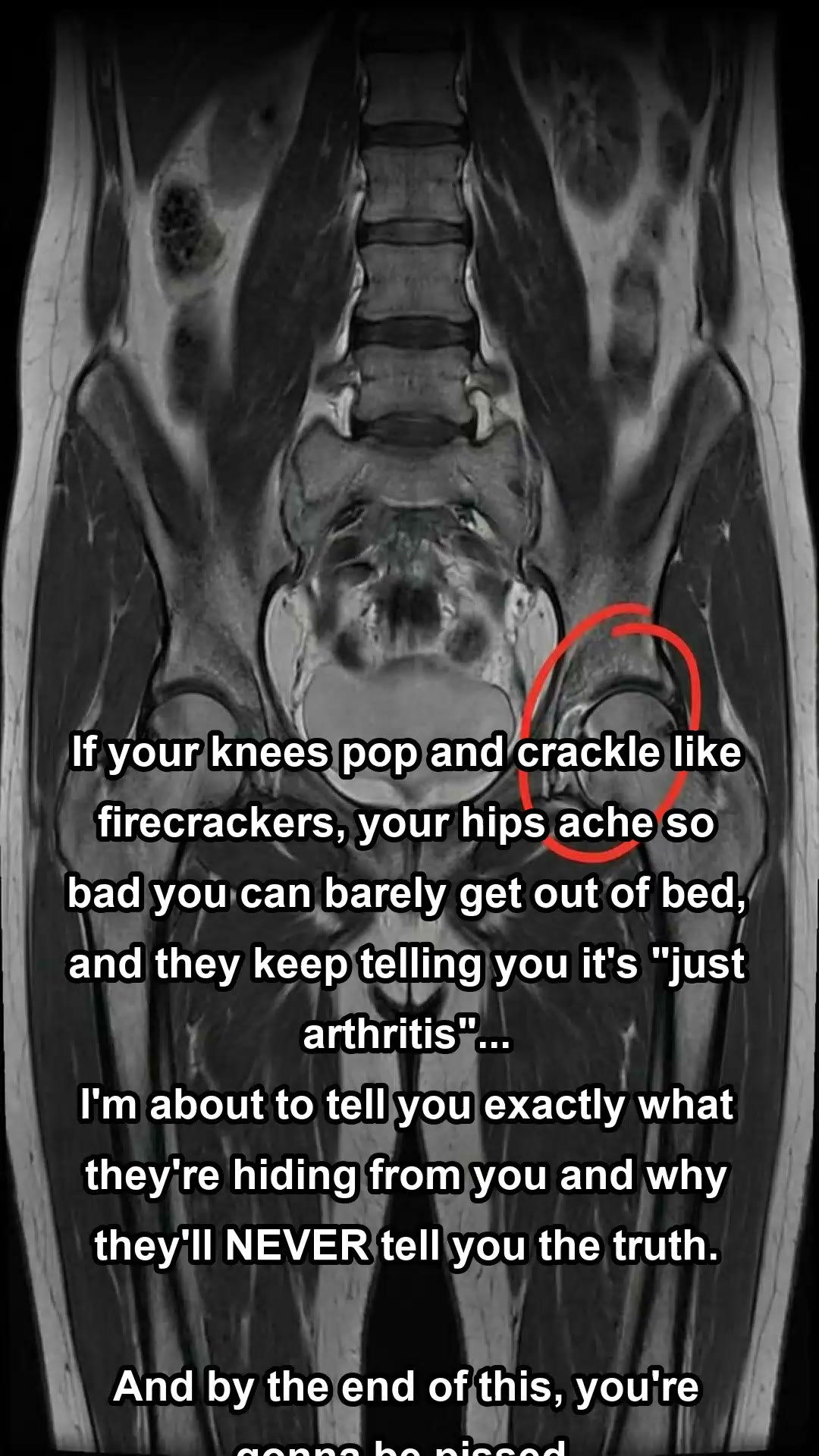 If you're struggling with joint pain, this is how I...