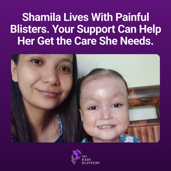 Shamila’s Skin Is Falling Off. Help Her.