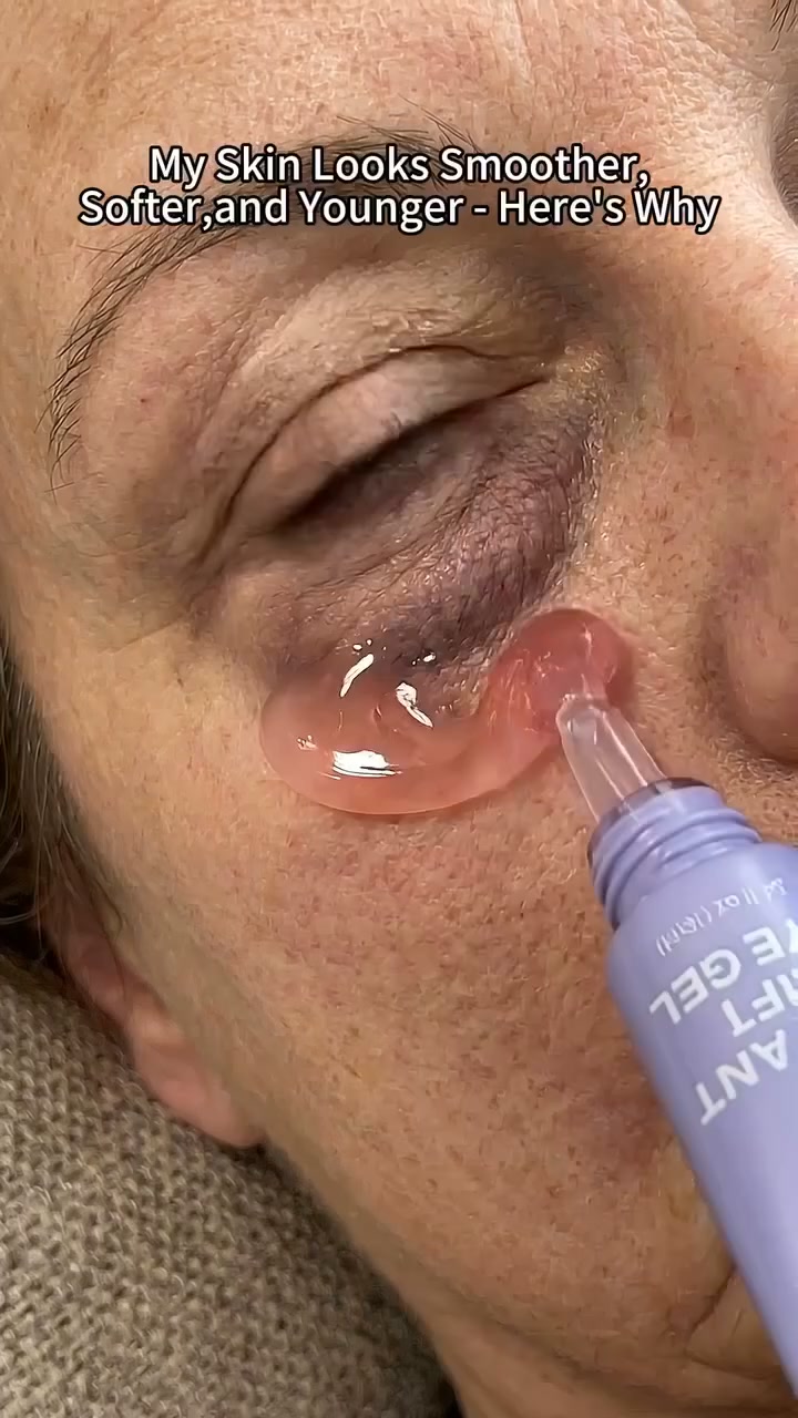 Instant Lift Eye Gel — Reduce the Look of Eye Bags in Minutes