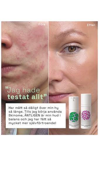 Från irriterad till balanserad hy