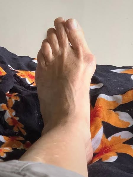 I Didn't Realise My Shoes Were The Problem.