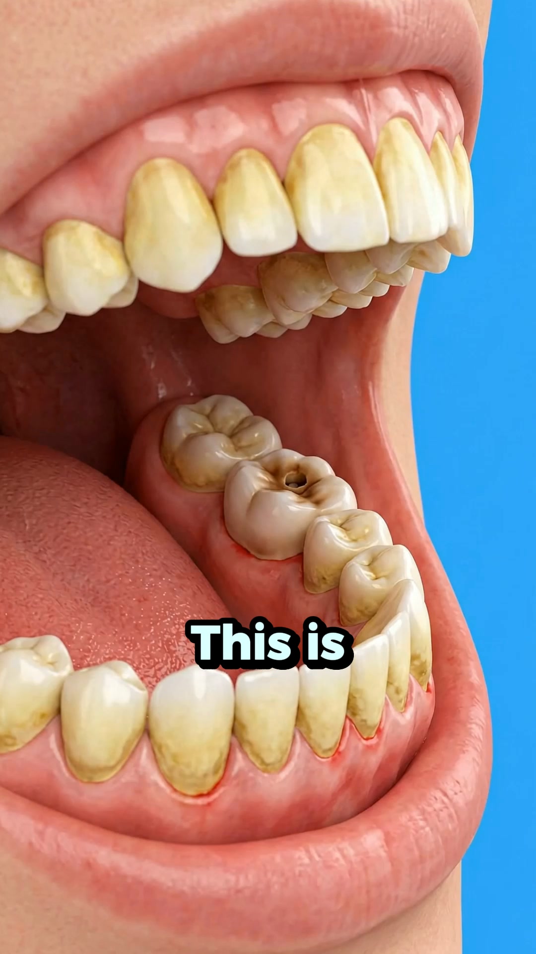 Whiter & Stronger Teeth