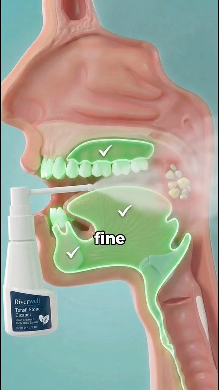 Why brushing never fixes it