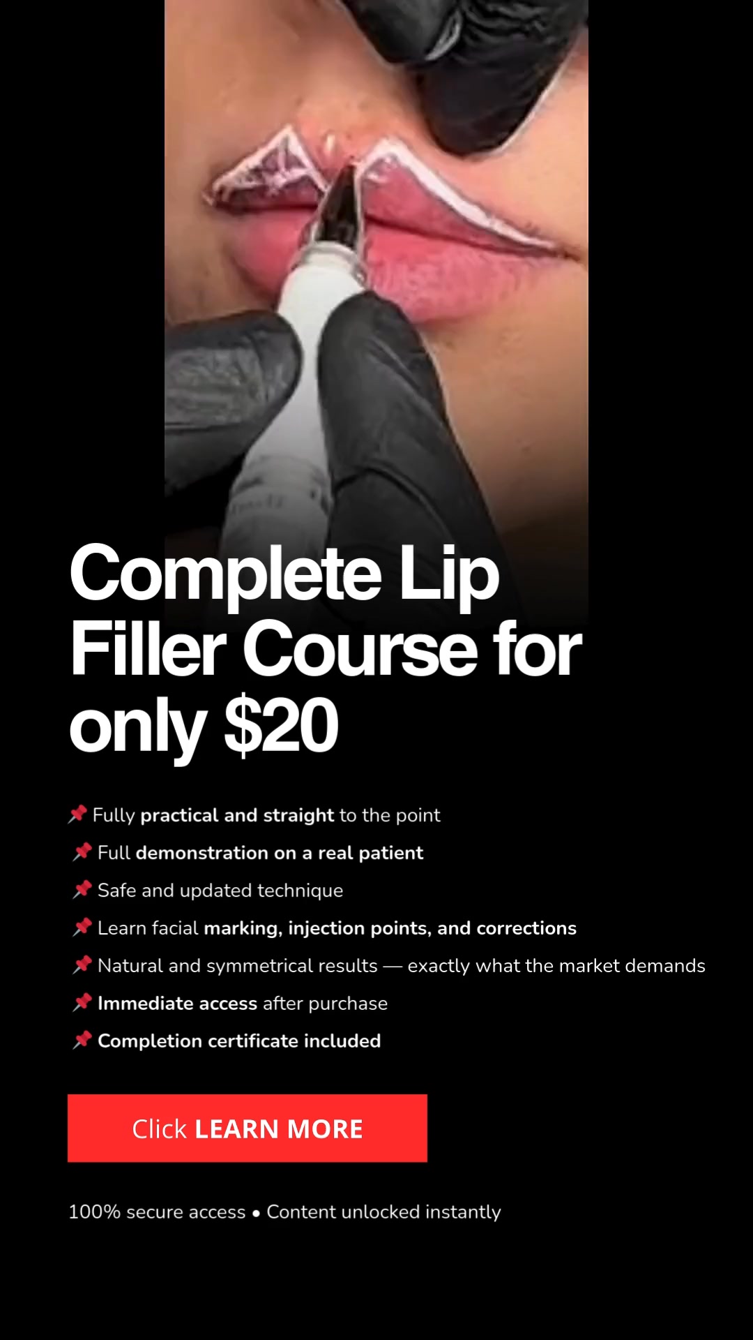Certified Lip Filler Training — Just $20!