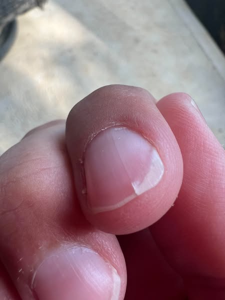 Read this if your nails are splitting...