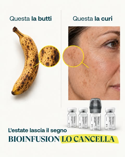 Macchie dopo l'estate? Prova questo