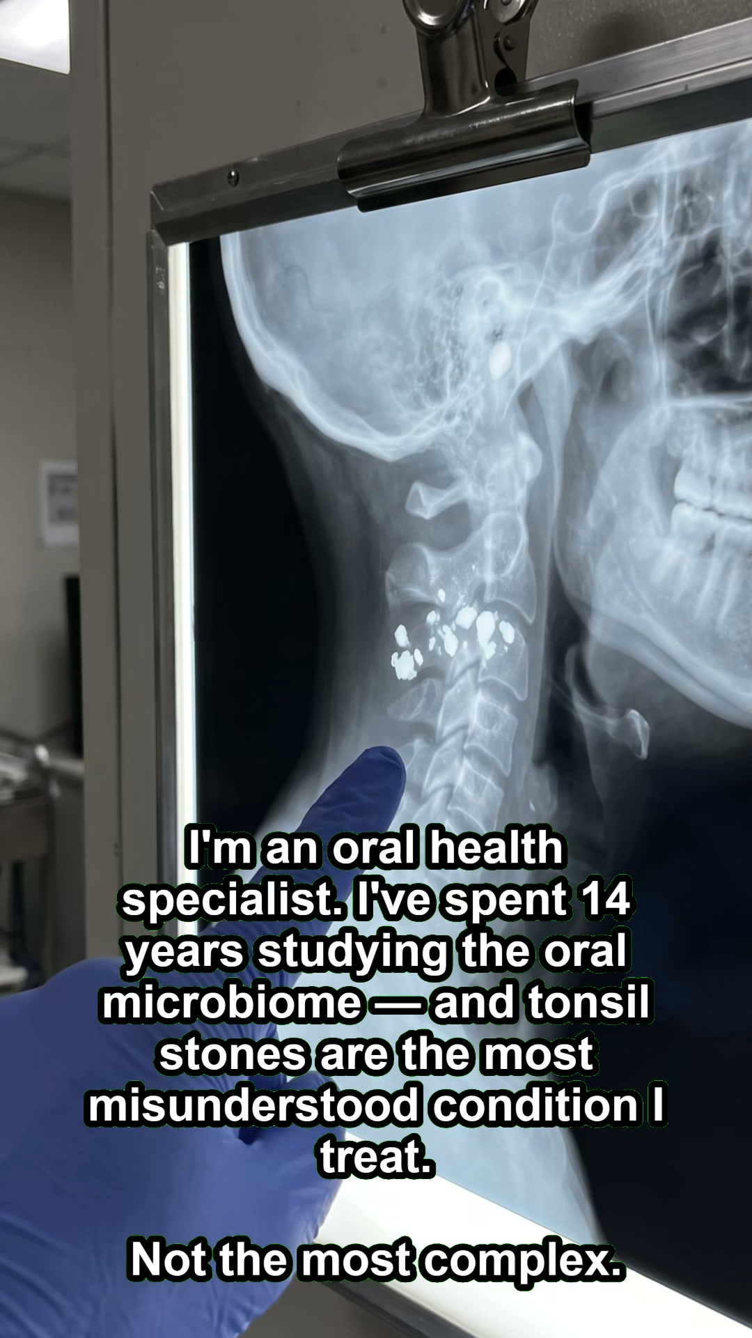If your bad breath is constant all day, it's not coming from your mouth