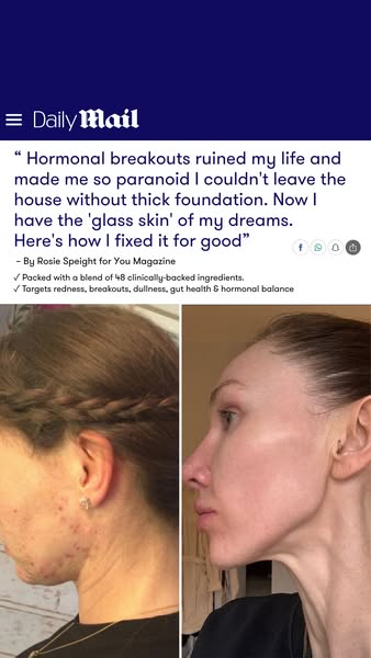 Hormonal skin? It starts from the inside.