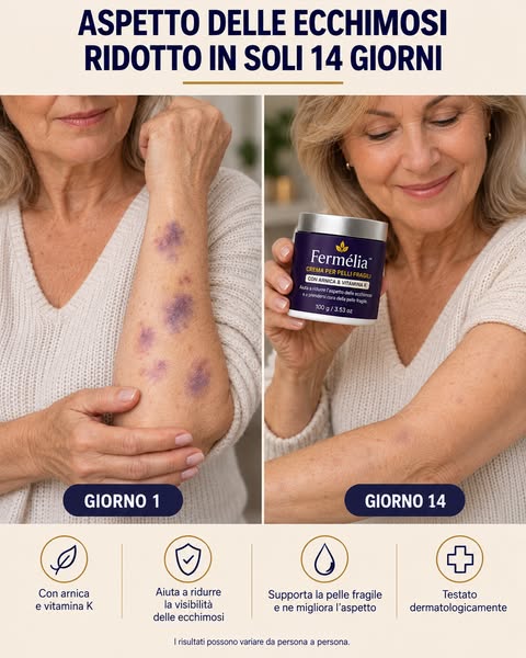 Fermélia™ — Cura mirata per pelli fragili