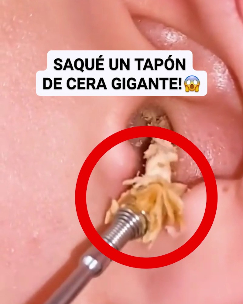 CONTRAREEMBOLSO