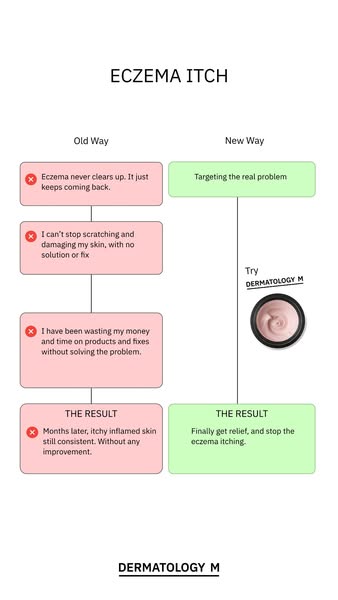 For Eczema-Prone Skin