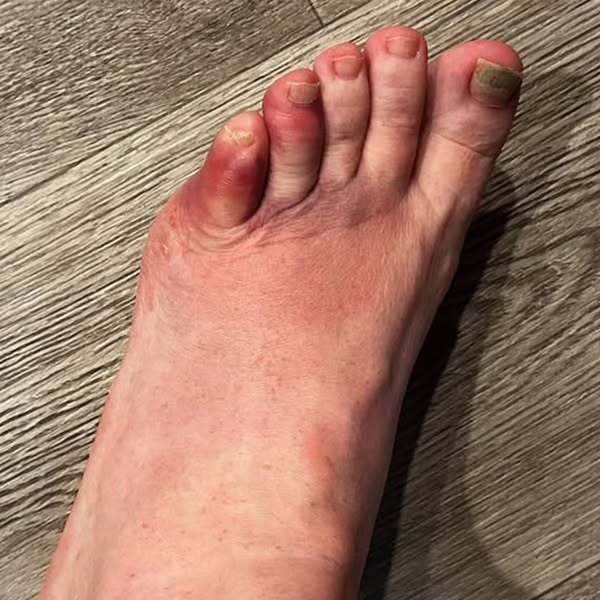 After years of pain, even my husband couldn't believe it