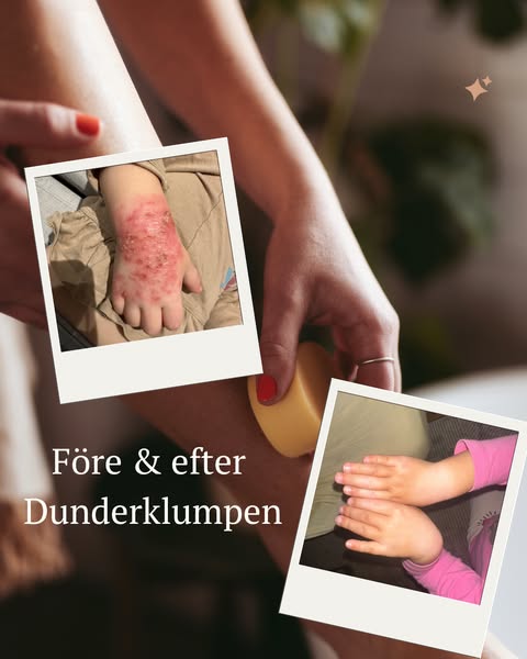Dunderklumpen , för den allra torraste huden
