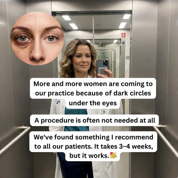 Dark circles and bags under the eyes: 1 old remedy helps