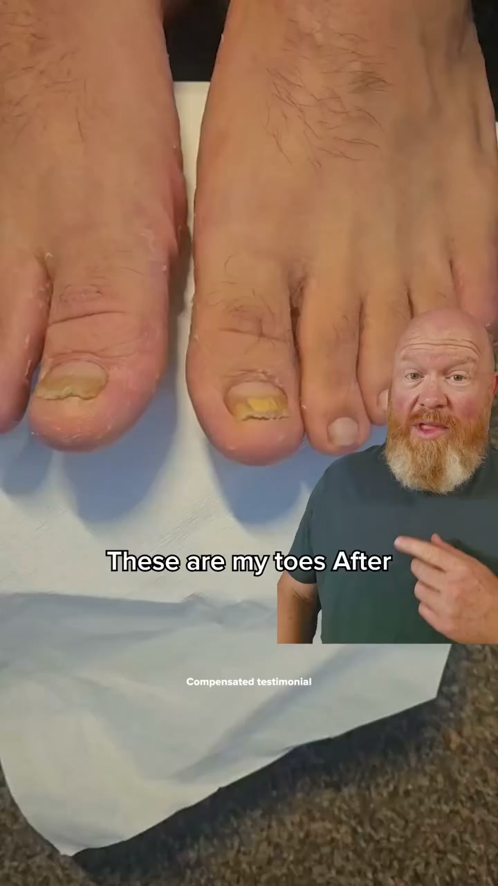 The Real Reason You’re Hiding Feet