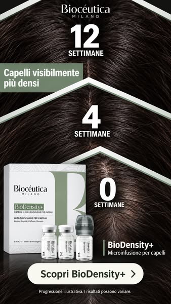Capelli diradati? Prova questo