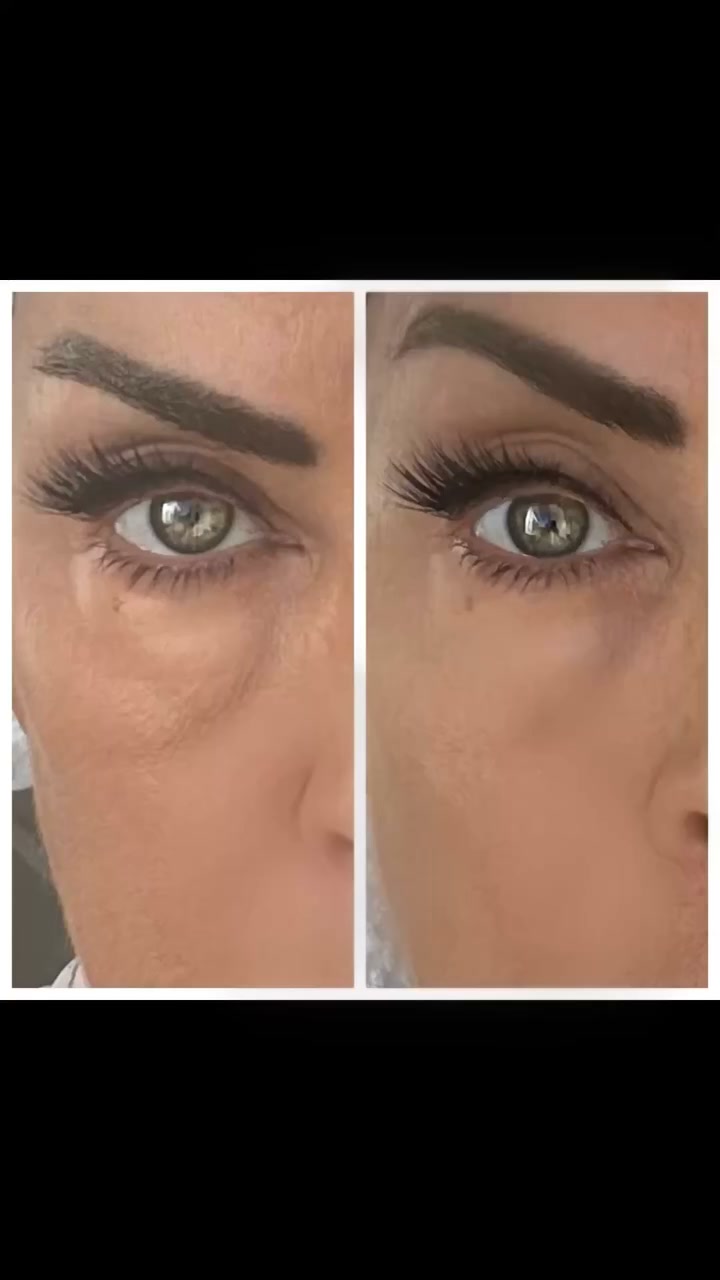 60-Second Eye Effects