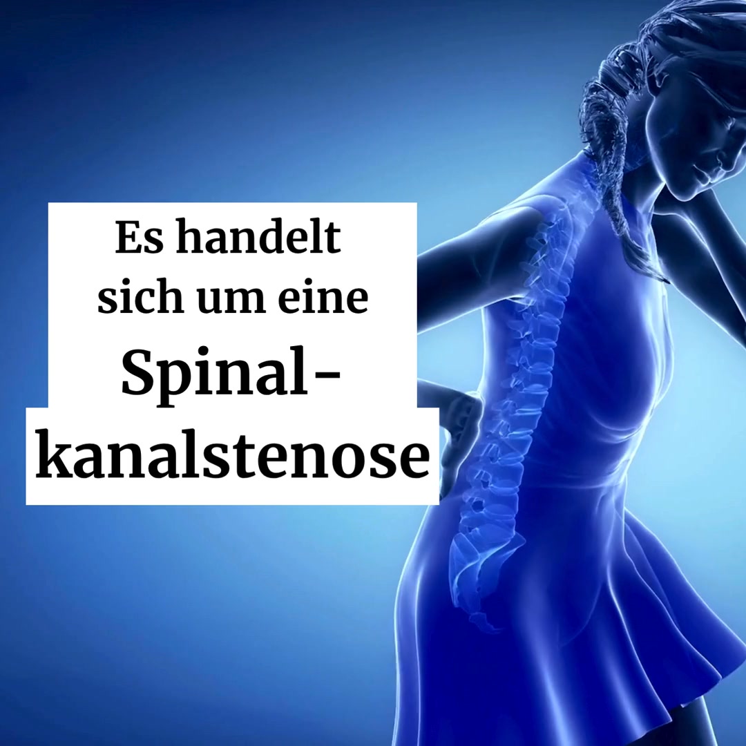 Spinalkanalstenose?