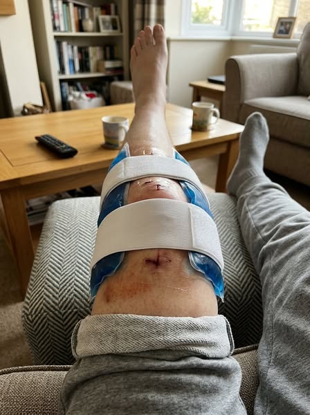 Nobody prepared me for BAD surgery