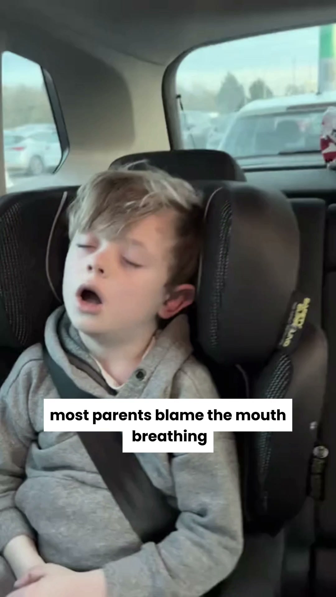 Your Child's Mouth Breathing Is Not A Phase