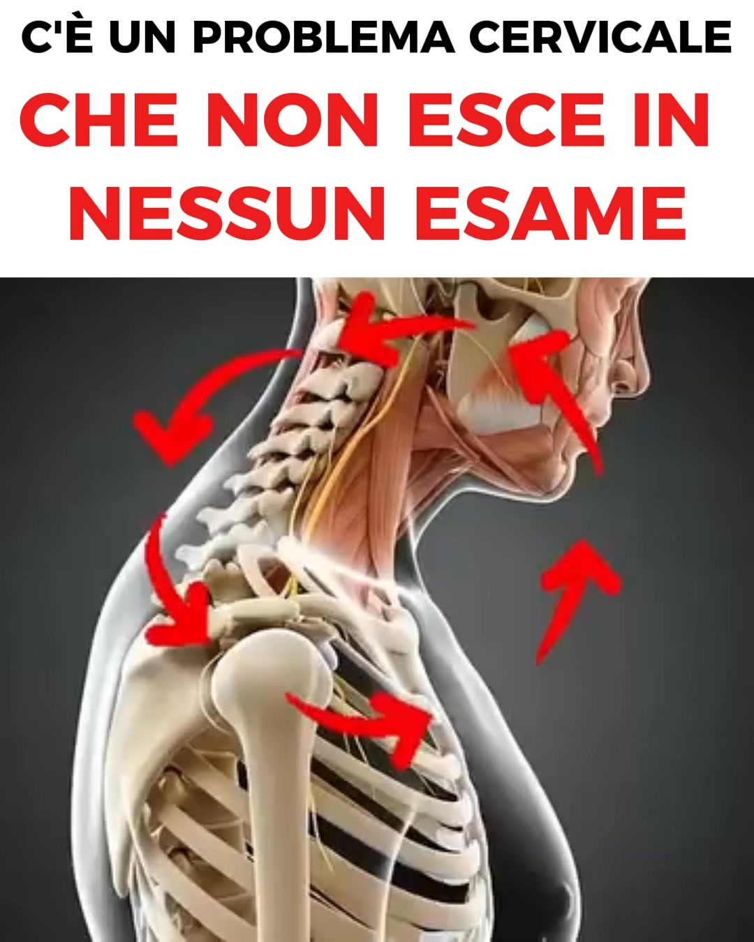 Perché Giramenti di Testa, Tachicardia e Reflusso Spesso Iniziano dal Collo