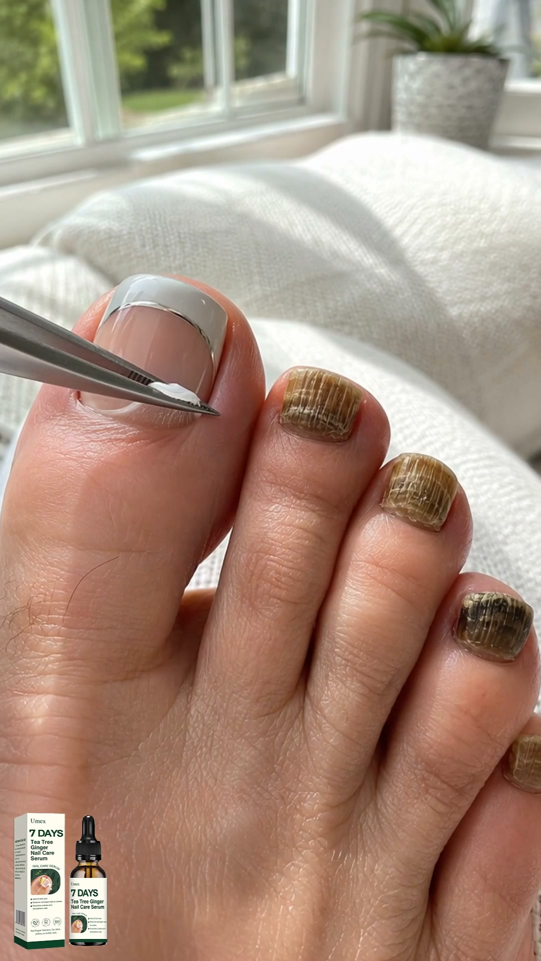 7 Days to Healthier-Looking Nails