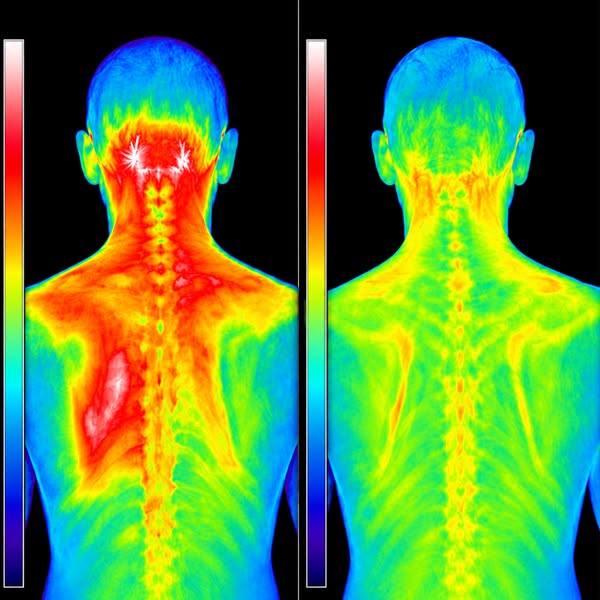 Read this if your neck pain is ruining your life