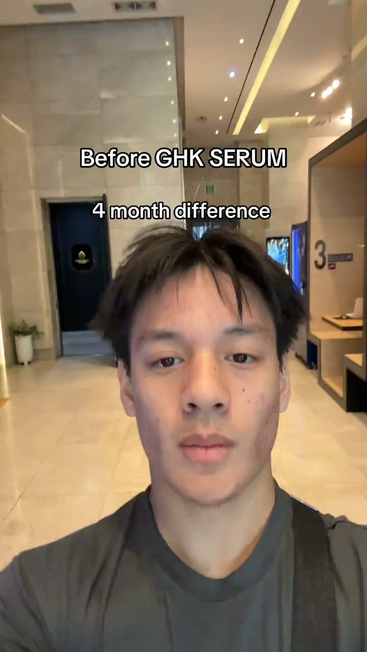 Clearer Skin Starts Here