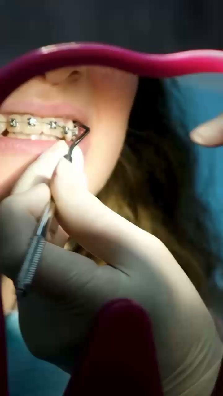 A Smarter Overnight Teeth Routine