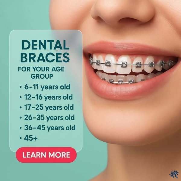 Dental Braces for Your Age Group
