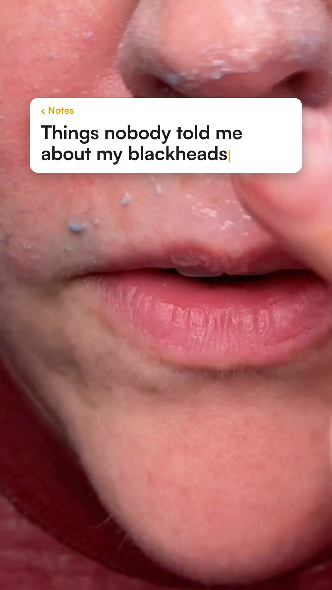 Say goodbye to blackheads