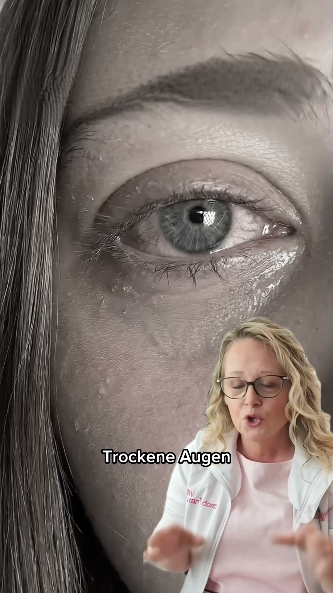 Trockene Augen lösen