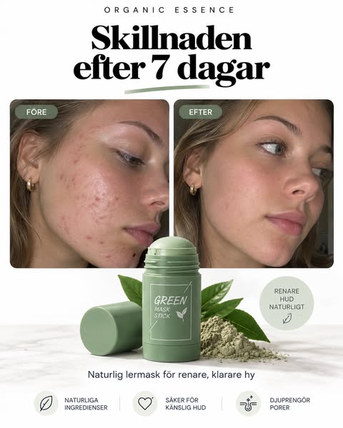 Minska akne naturligt