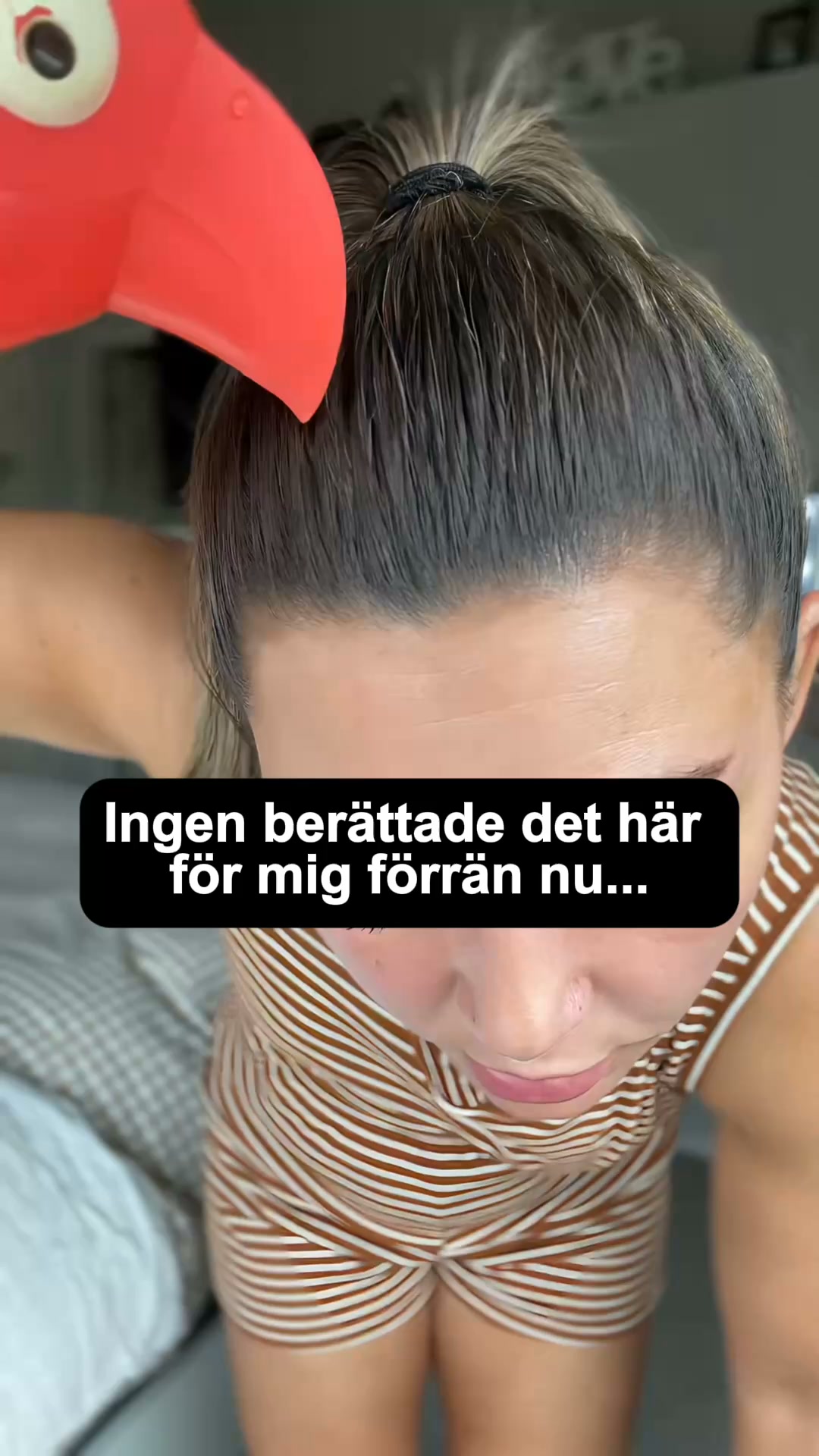 Hårbotten som syns? Lösningen är här.