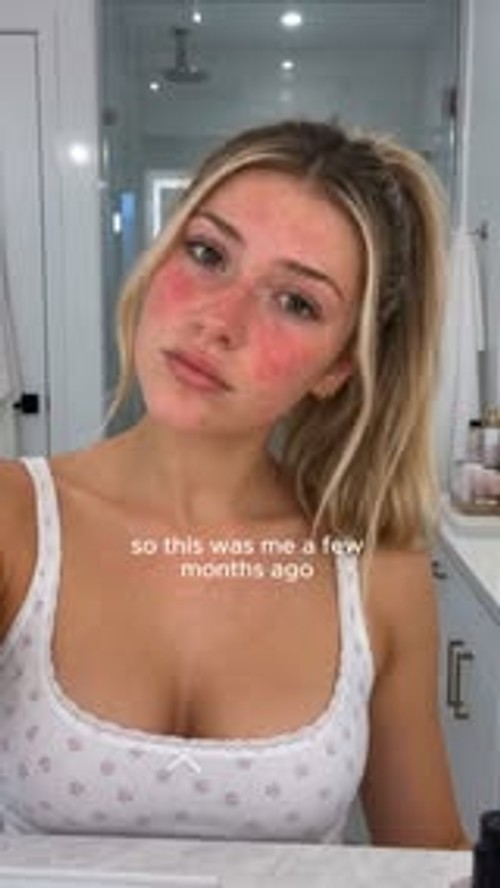 Nothing Goes On Your Face