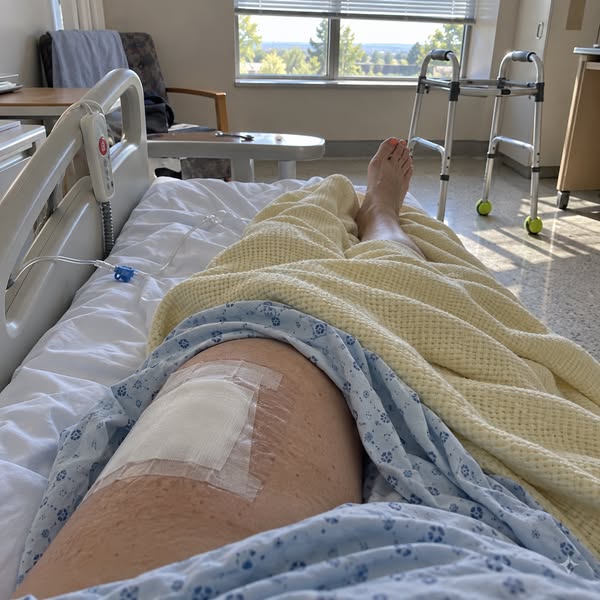 I Fell on My Hip. Women Over 50, Read This.