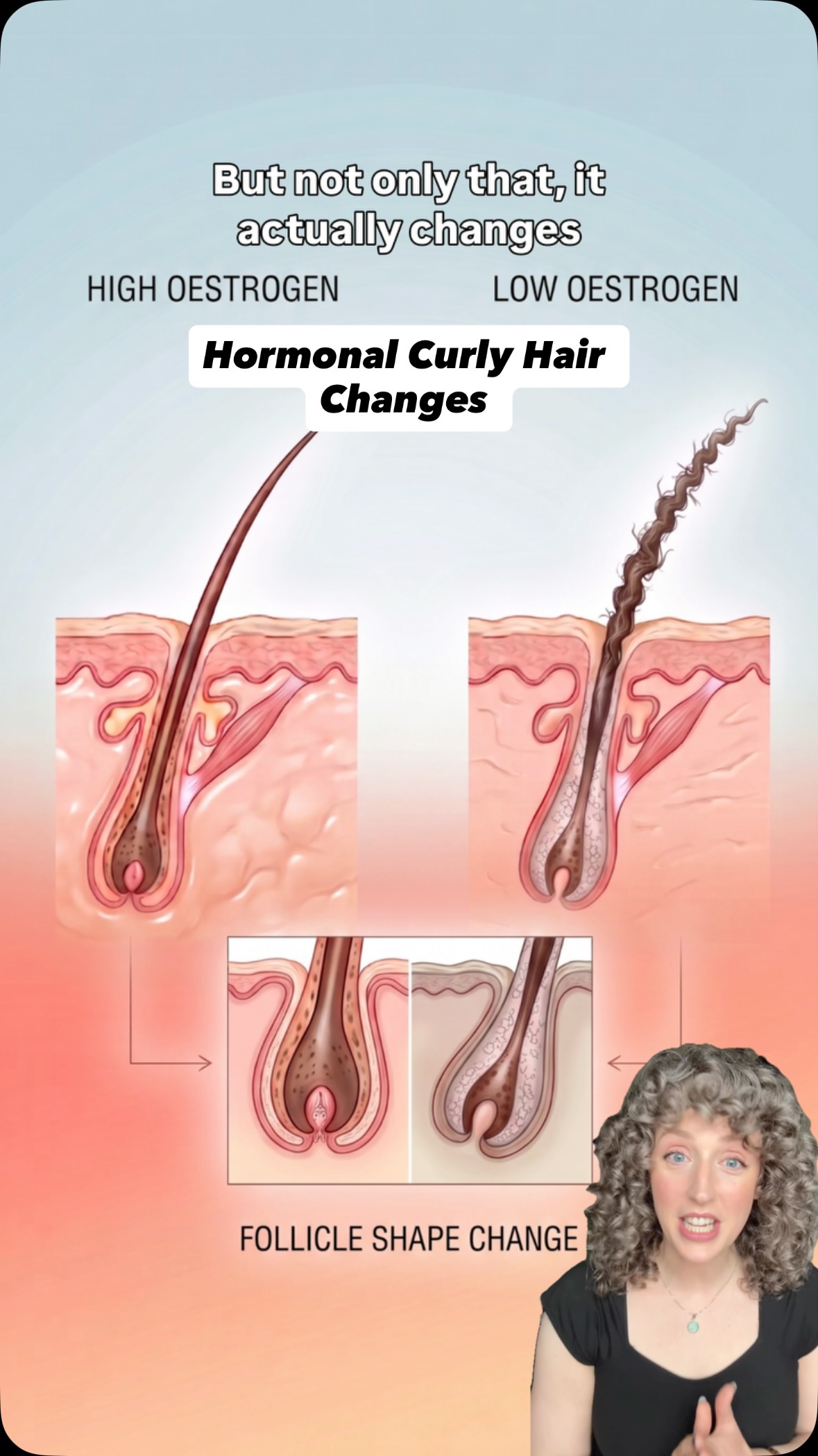 Your hormones can drastically change your hair?