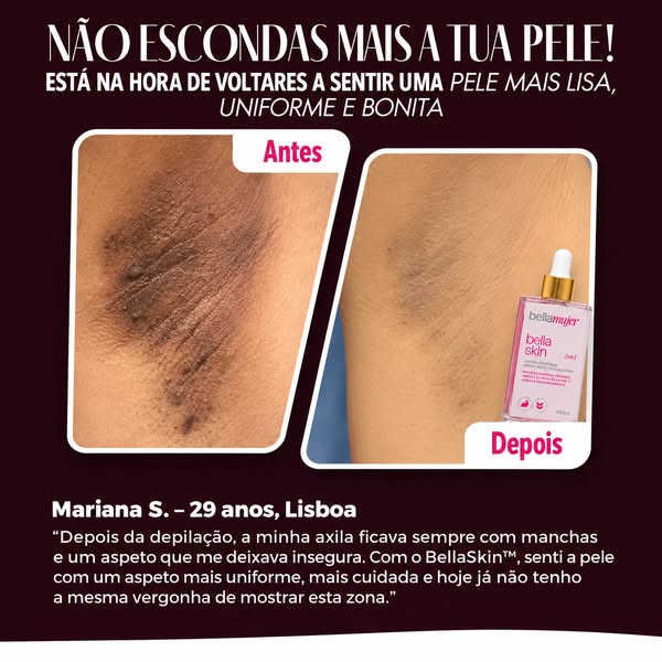 ULTIMAS UNIDADES DISPONIVEL!