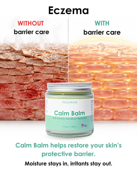 End the Struggle of Sore Skin for Good!