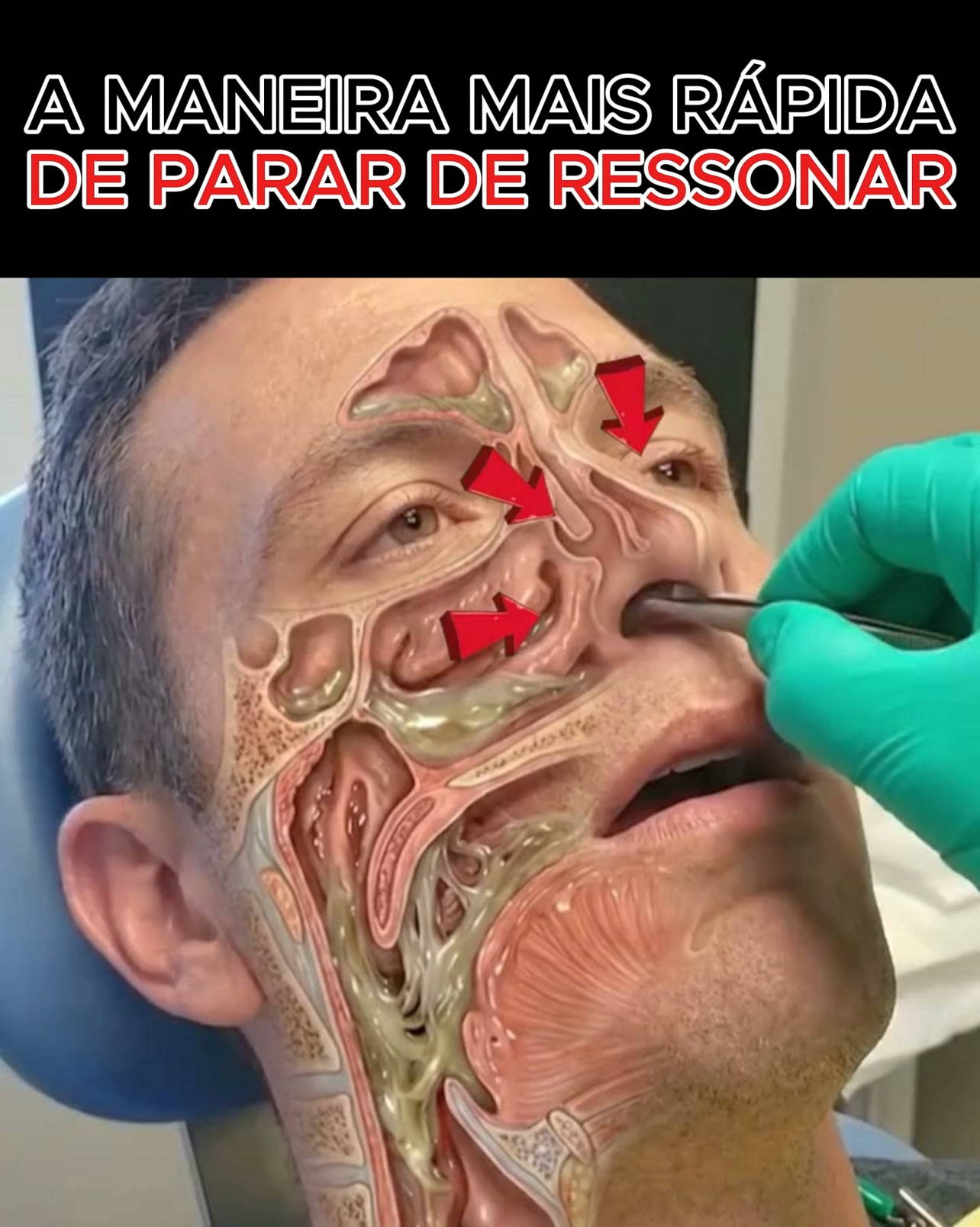Como parar de ressonar em 7 segundos