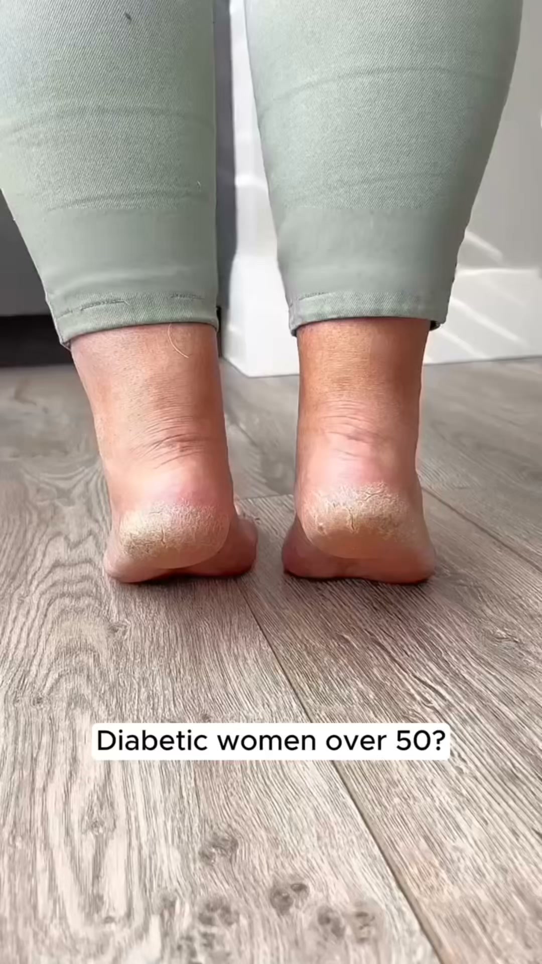 Cracked diabetic heels? Vaseline won’t touch this…