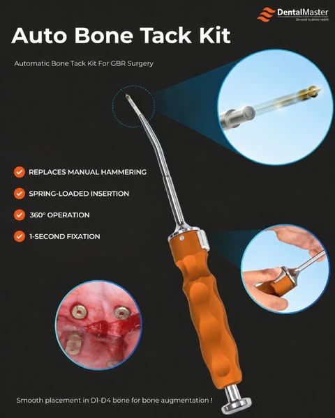 Auto Bone Tack Kit
