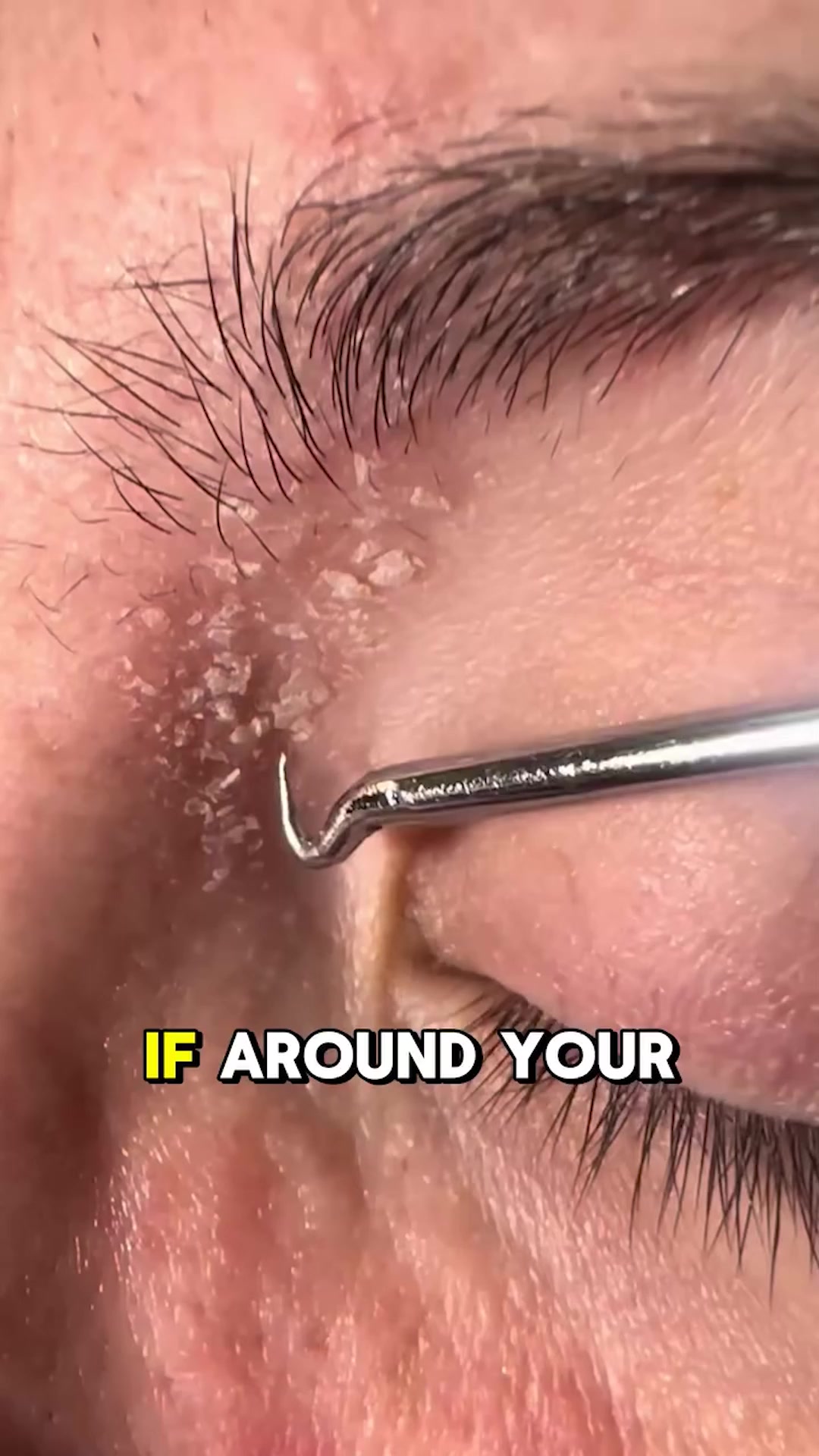 Stop Feeding the Yeast. Start Seeing Results.